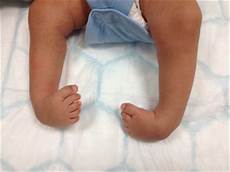 Infant Ankle Socks