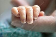 Newborn Baby Grip